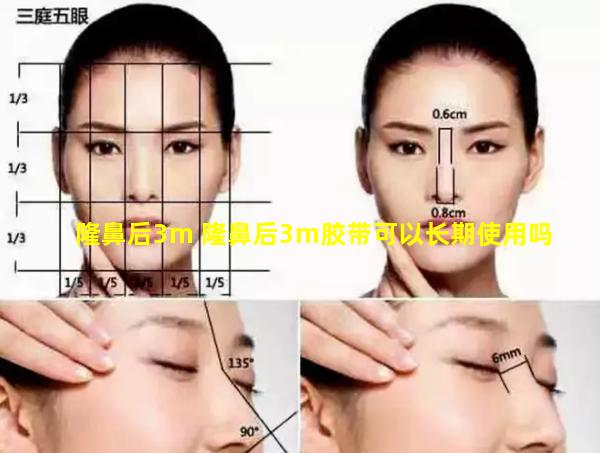 隆鼻后3m 隆鼻后3m胶带可以长期使用吗